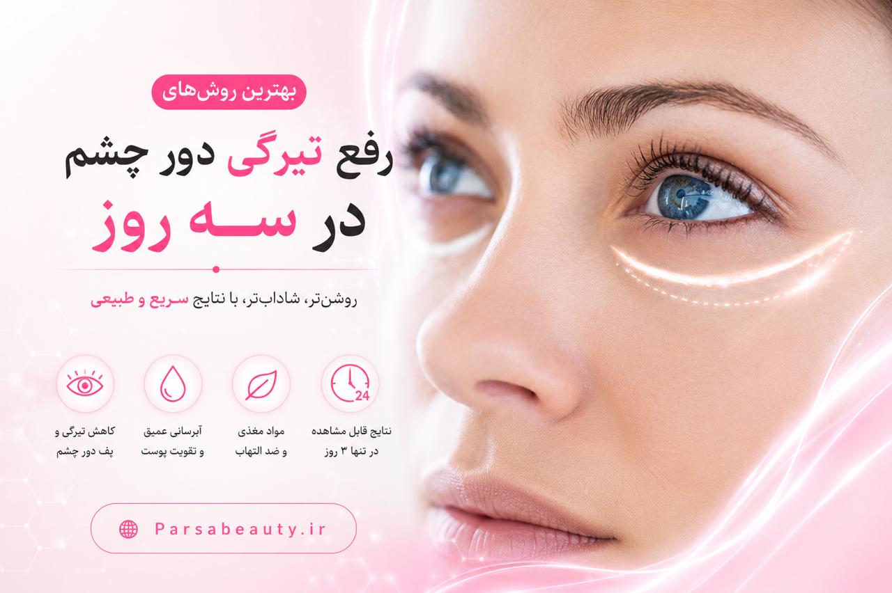 بهترین روشهای رفع تیرگی دور چشم در سه روز